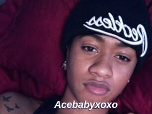 Acebabyxoxo