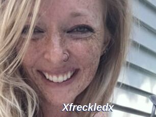 Xfreckledx